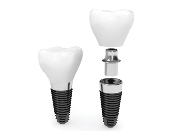 implantd