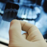 Sunt importante radiografiile dentare?