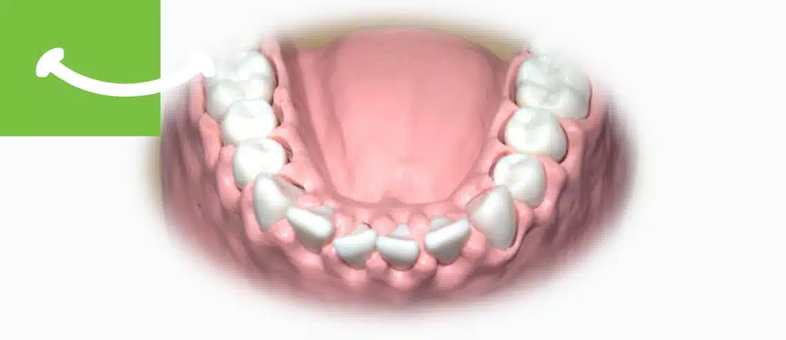 Dreossi Dental - Parodontologie